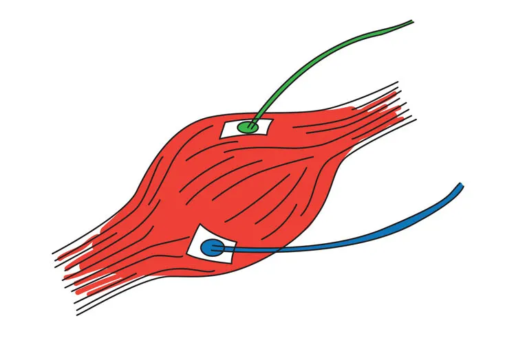 Muscle with Wires for Blog.jpg